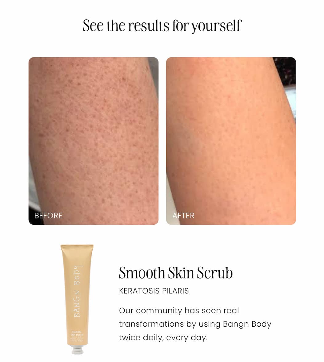 See the results for yourself. Smooth skin scrub. Keratosis pilaris. Our community has seen real transformations by using Bangn Body twice daily, everyday. 