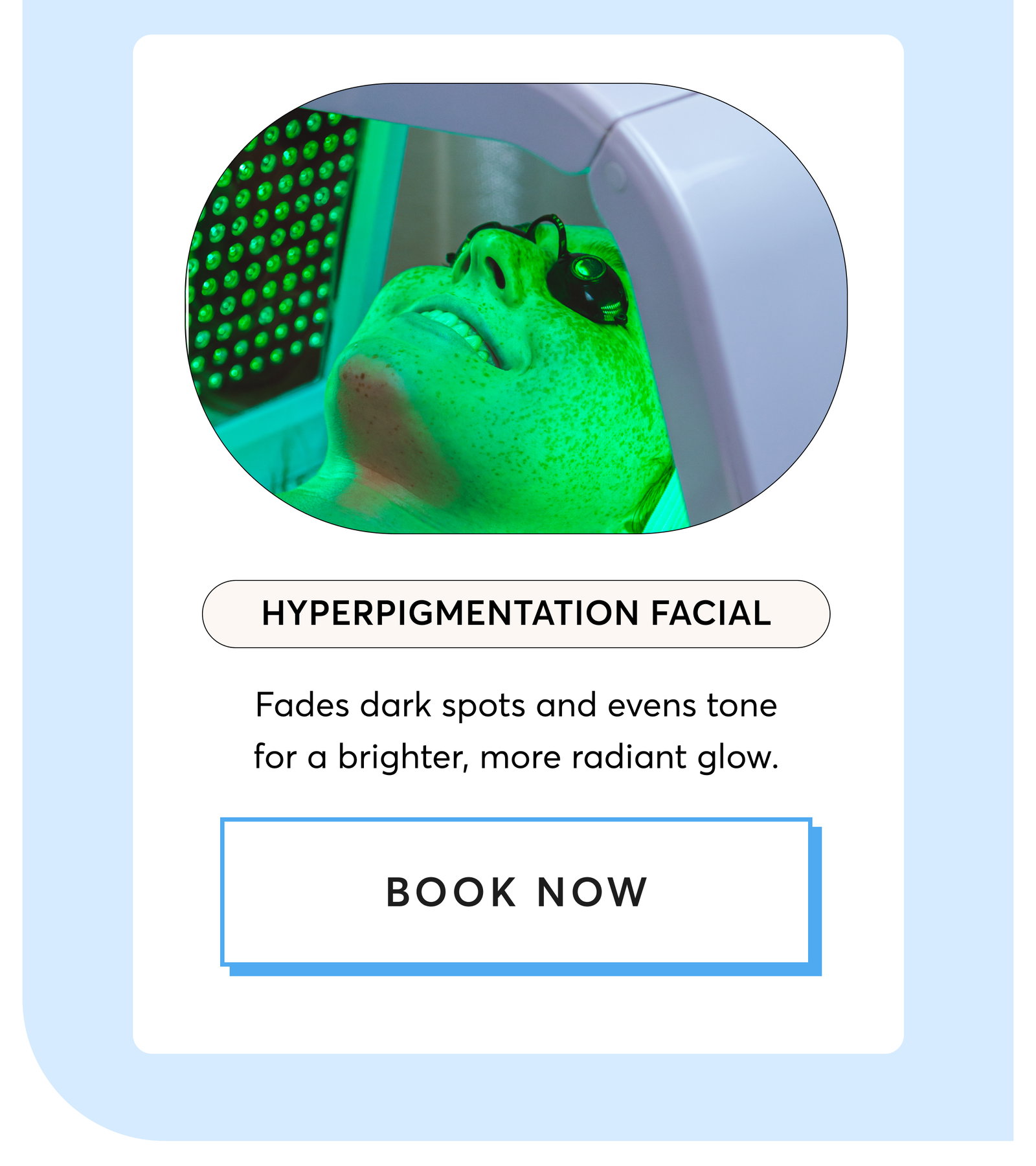 Hyperpigmentation Facial