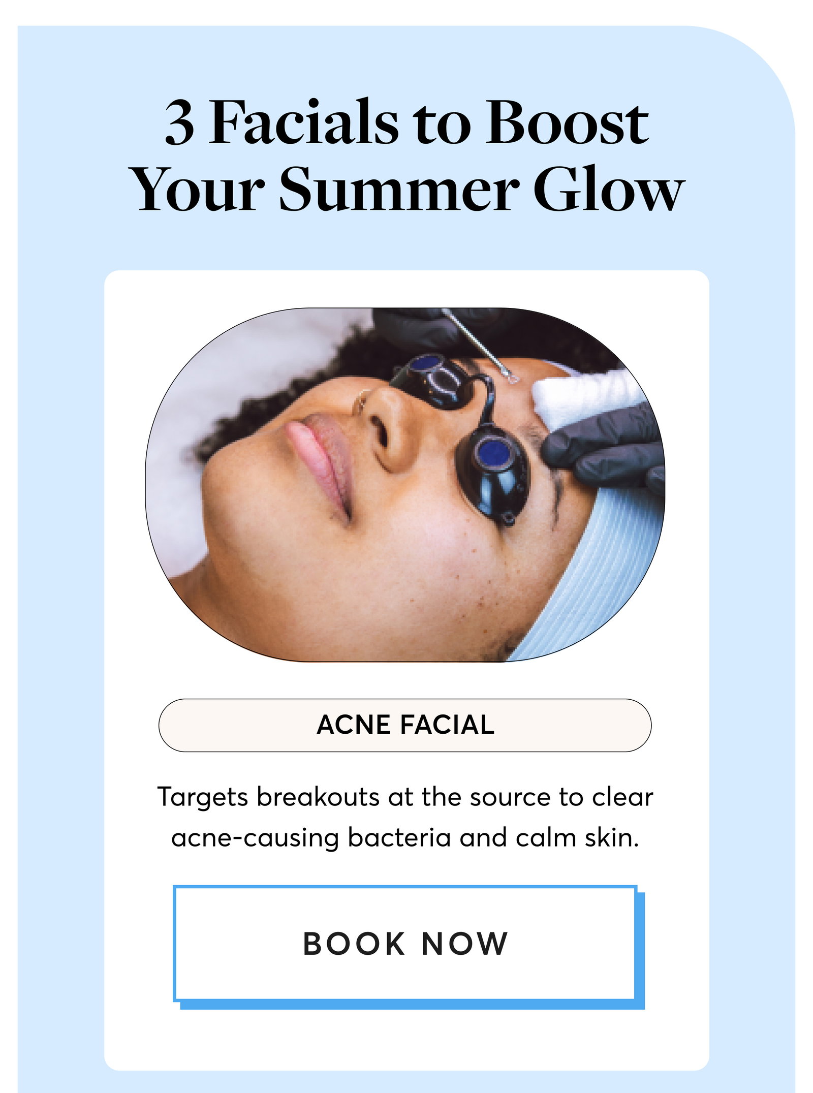 Acne Facial