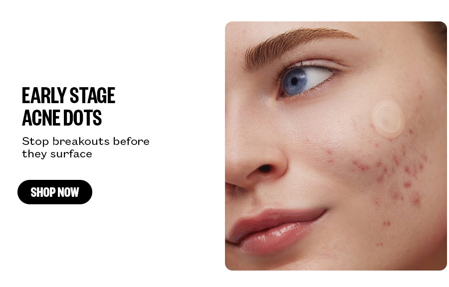 Early Stage Acne Dots - Stop breakouts before they surface