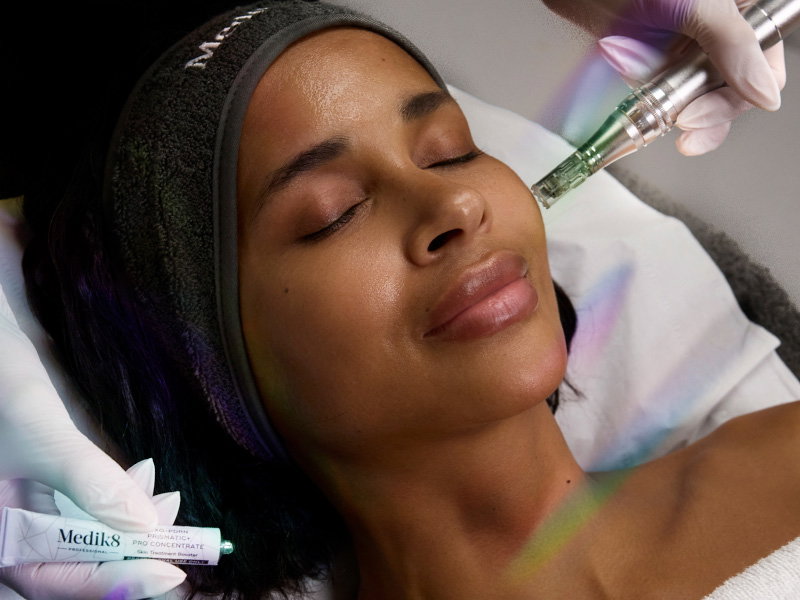 A close-up of a woman lying back with eyes closed while receiving a professional microneedling treatment, as a practitioner applies serum to her cheek using a microneedling device. A product tube is held near.