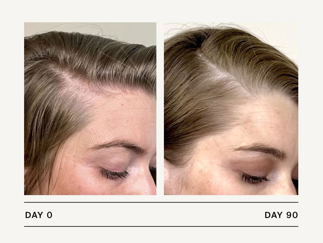 Living Proof | Scalp Care Density Serum