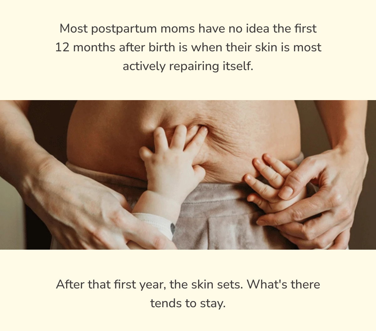 Most postpartum moms have no idea the first 12 months after birth is when their skin is most actively repairing itself.  After that first year, the skin sets. What's there tends to stay.