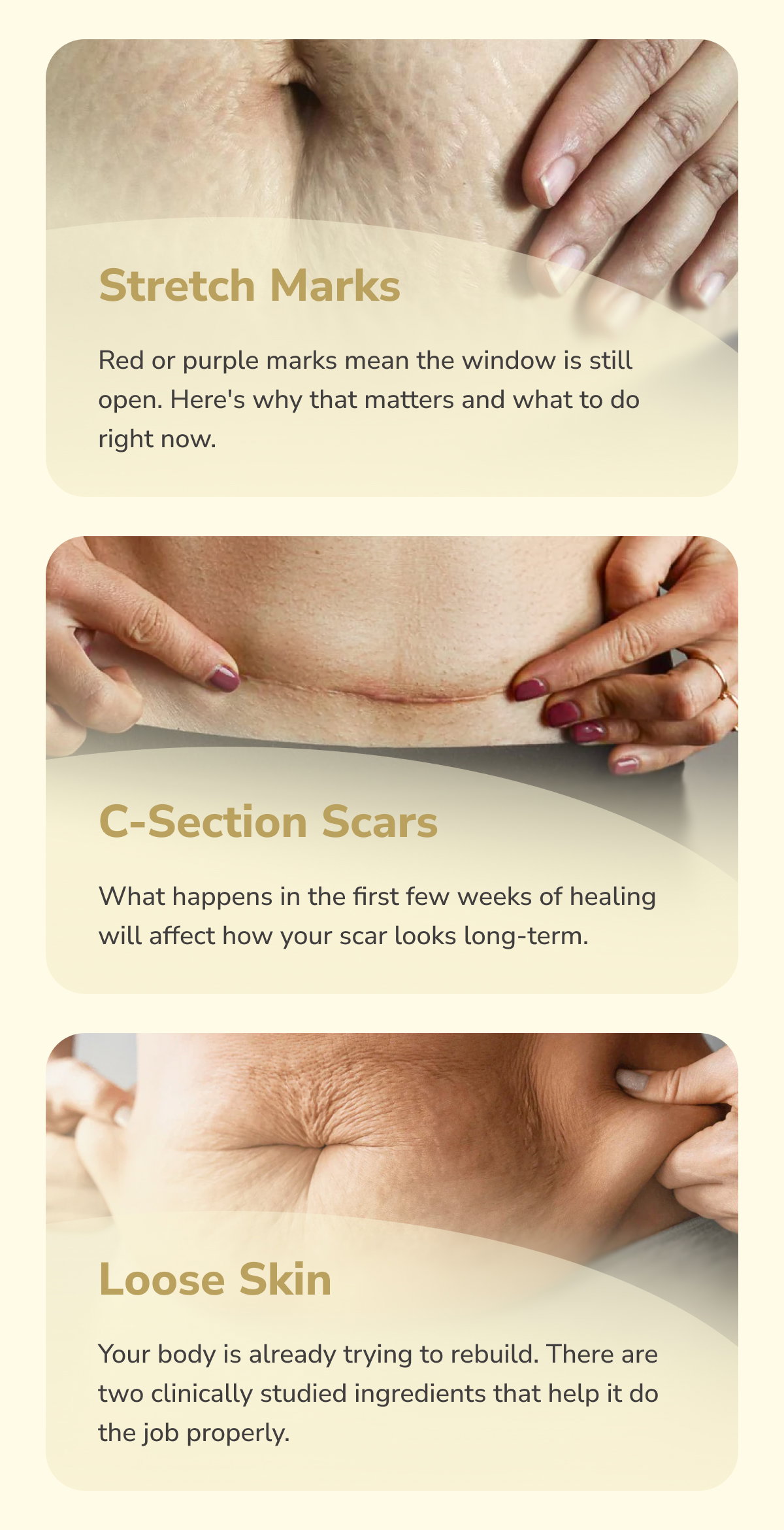 Stretch Marks. Red or purple marks mean the window is still open. Here's why that matters and what to do right now. C-Section Scars. What happens in the first few weeks of healing will affect how your scar looks long-term. Loose Skin. Your body is already trying to rebuild. There are two clinically studied ingredients that help it do the job properly.