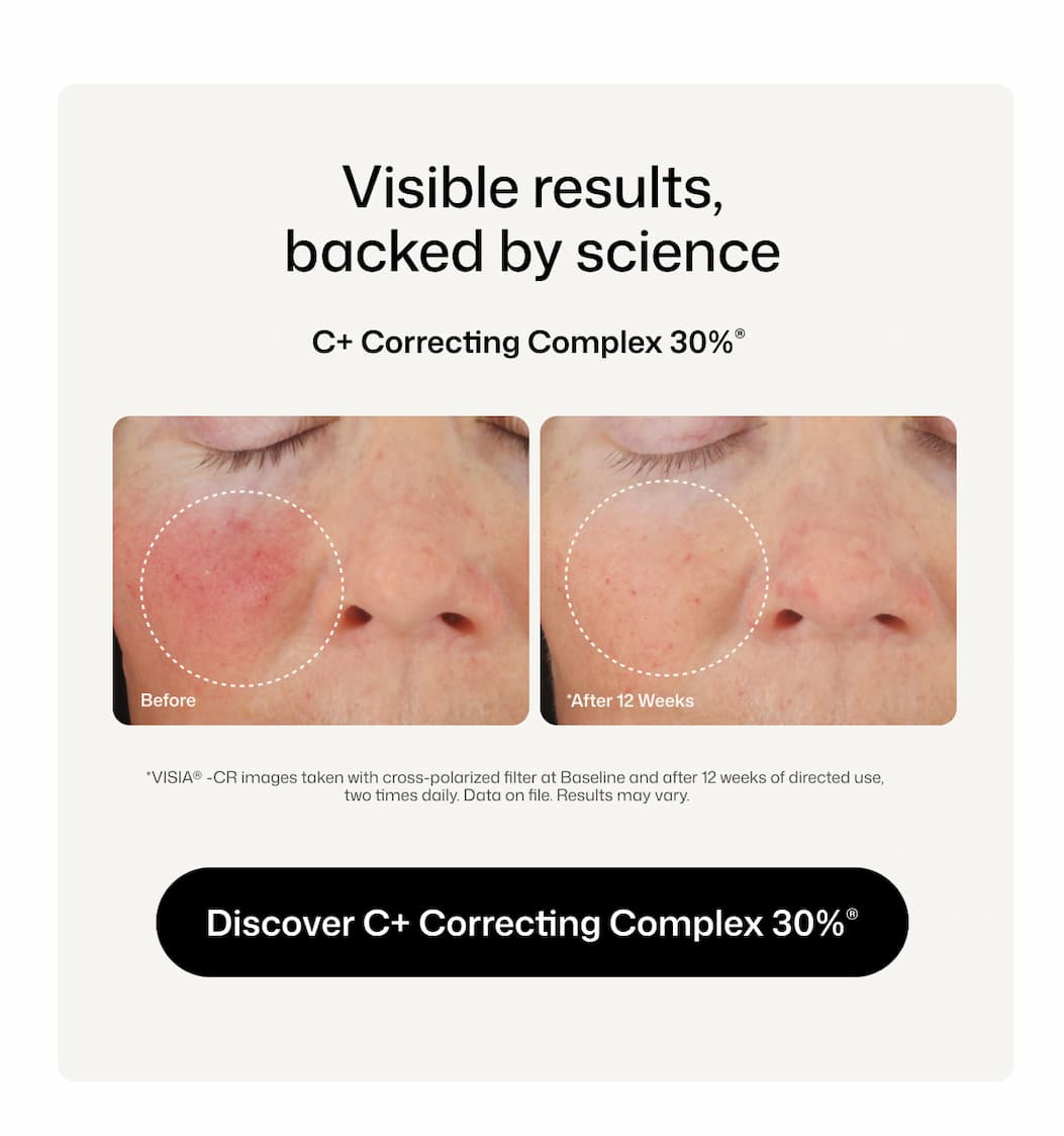 REAL RESULTS - C+ Correcting Complex 30%® 0.5 oz