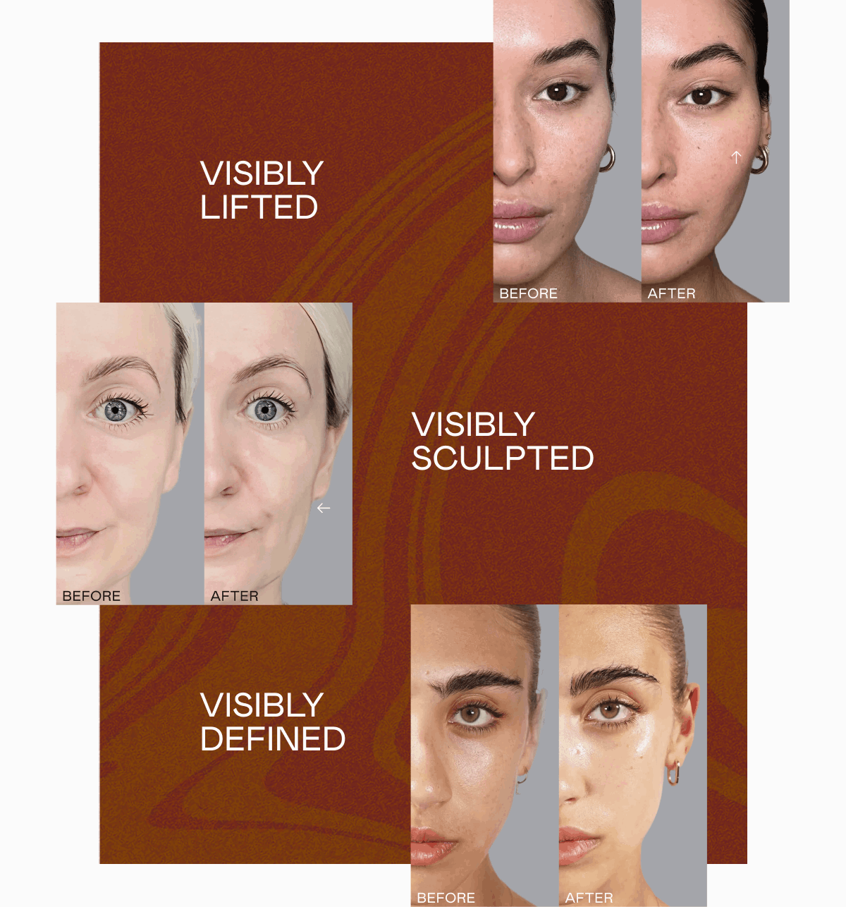 Visibly Lifted. Visibly Sculpted. Visibly Defined.