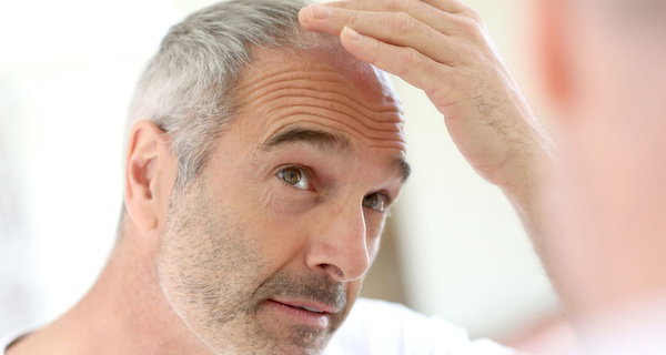 PRP Hair Restoration at Skinovatio Arlington Heights