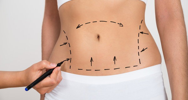 Explore Non-Invasive Laser-Lipo Sculpting Treatments