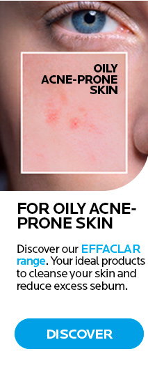 oily acne