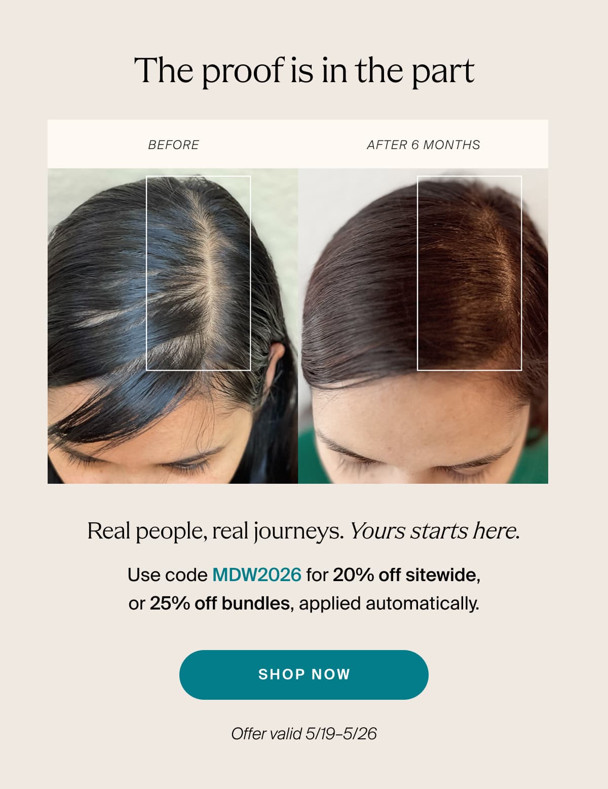 The proof is in the part | Real people, real journeys. Yours starts here. | Use code MDW2026 for 20% off sitewide, or 25% off bundles, applied automatically. | shop now | Offer valid 5/19–5/26