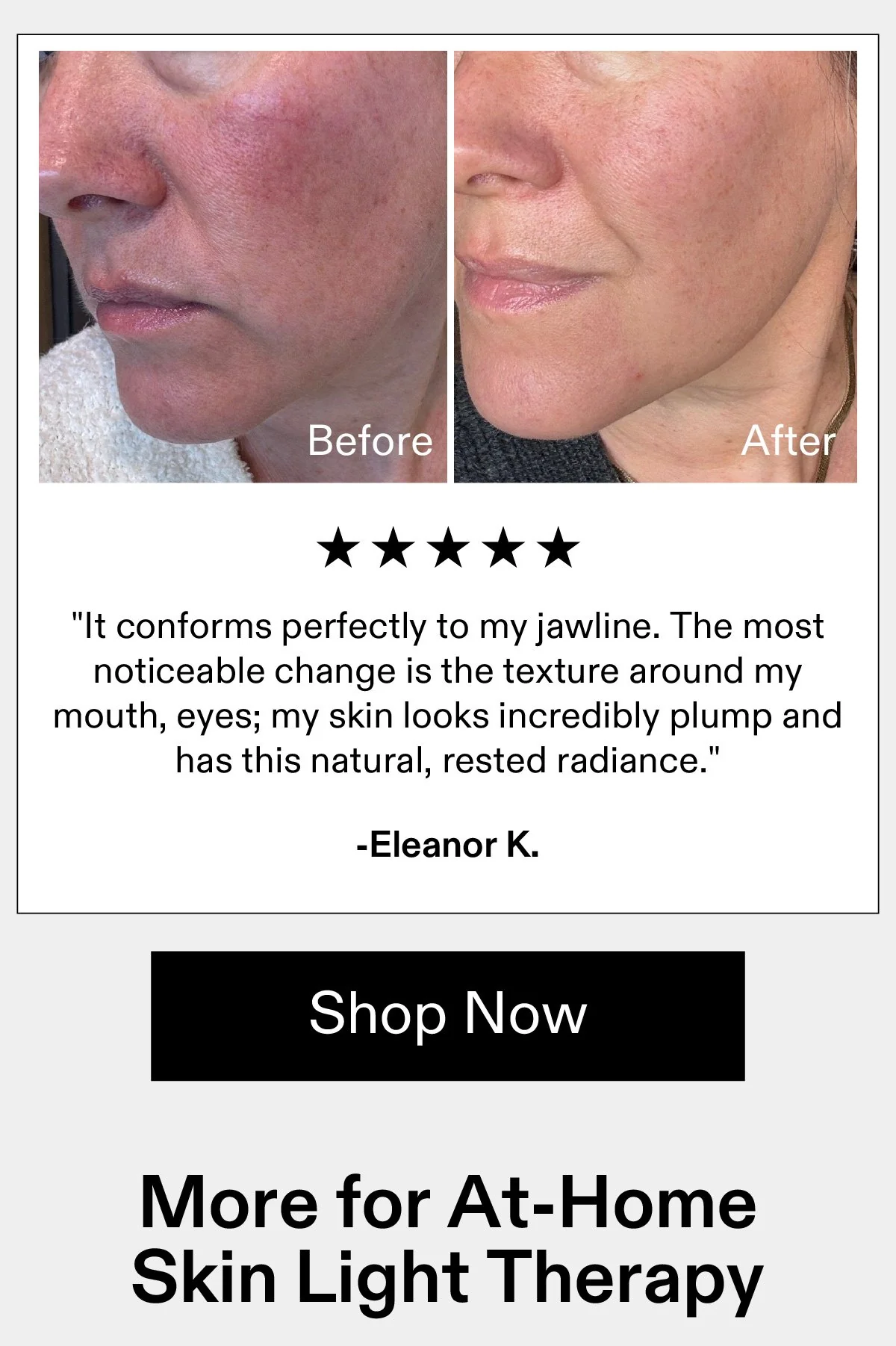 Real Results. Radiant Skin.