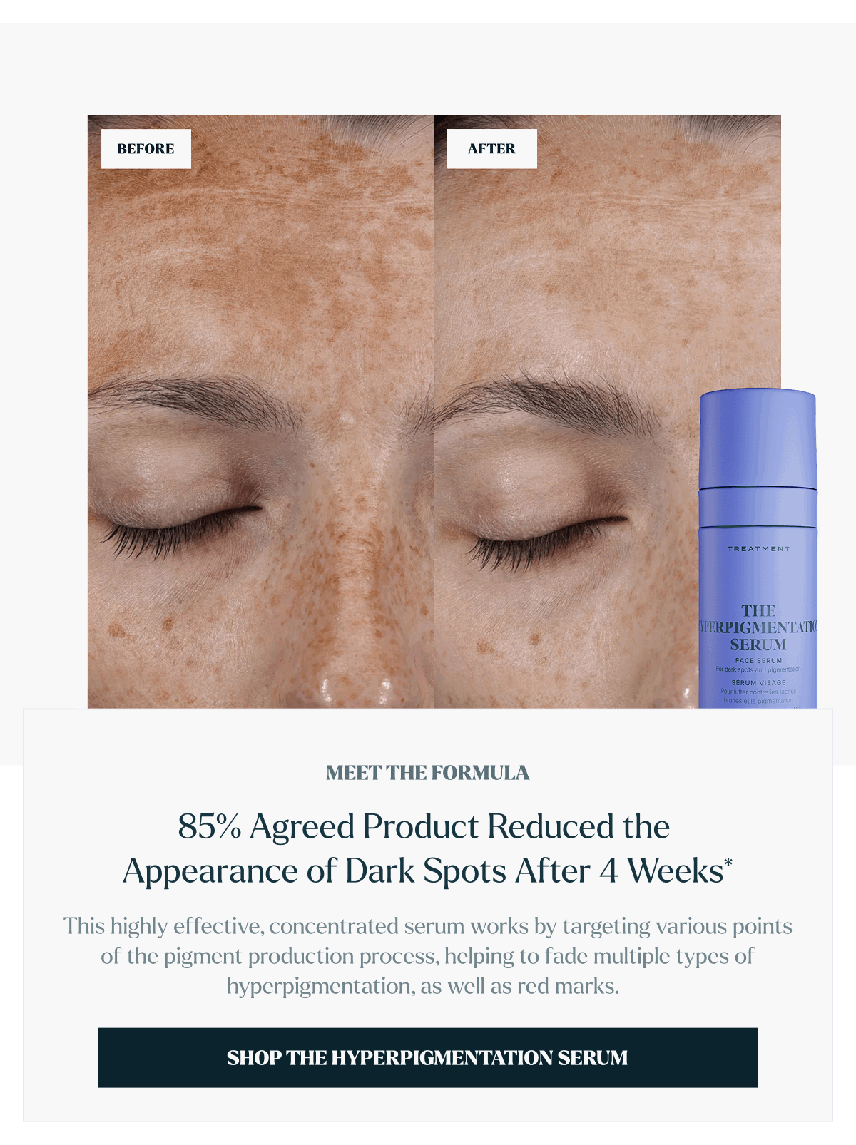 Shop The Hyperpigmentation Serum