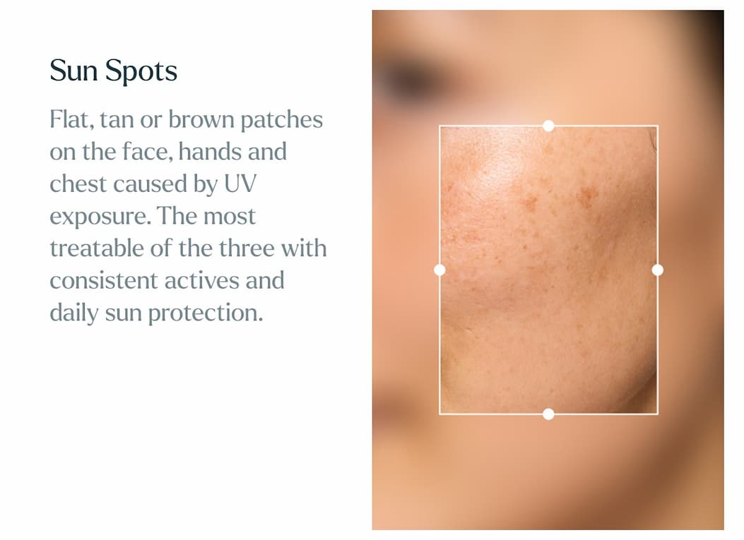 Sun Spots