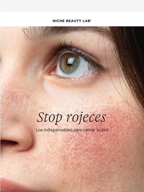 Stop Rojeces 🔴 3 indispensables para calmar tu piel