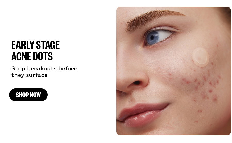 Early Stage Acne Dots - Stop breakouts before they surface