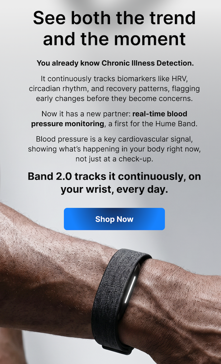 See both long-term changes and real-time insight from your wrist.