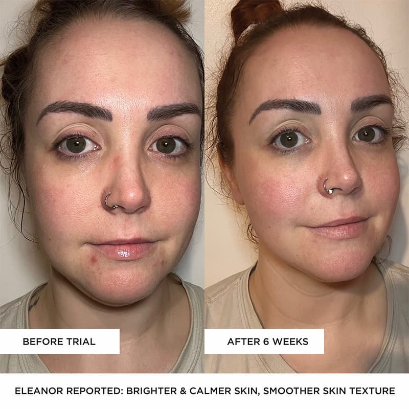 BEAUTYPRO LED mask results before and after