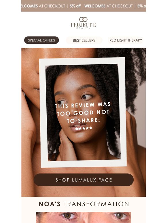 No more acne, scars and inflammation