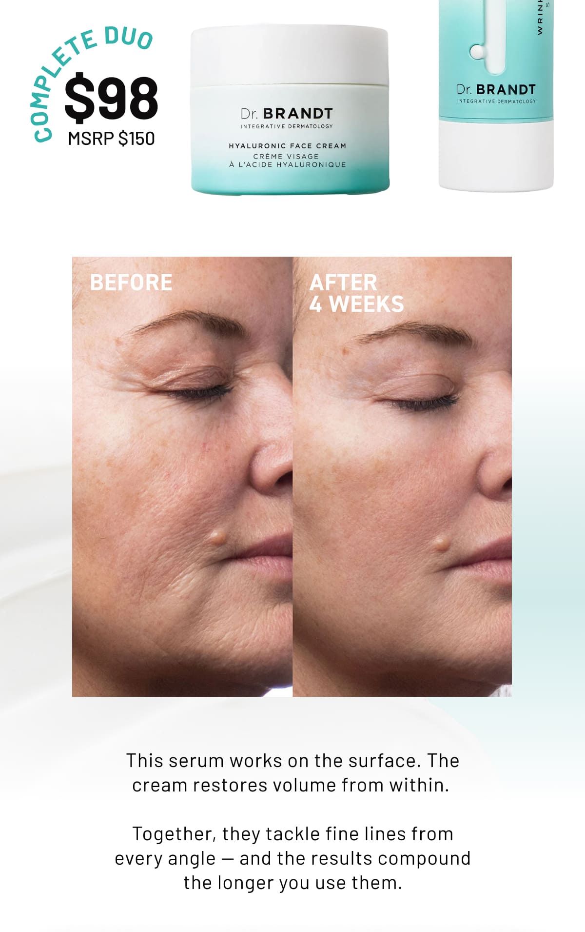 This serum works on the surface. The cream restores volume from within. 