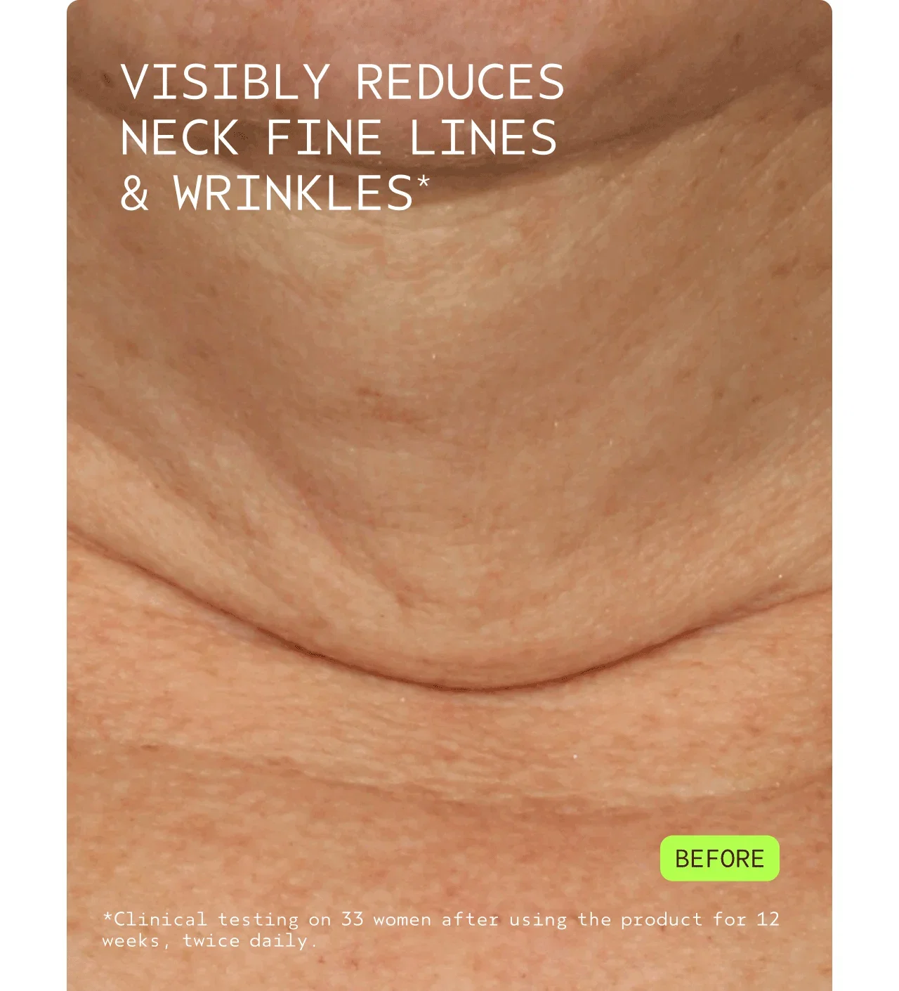 VISIBLY REDUCES NECK FINE LINES & WRINKLES* | Before | After | *Clinical testing on 33 women after using the product for 12 weeks, twice daily.