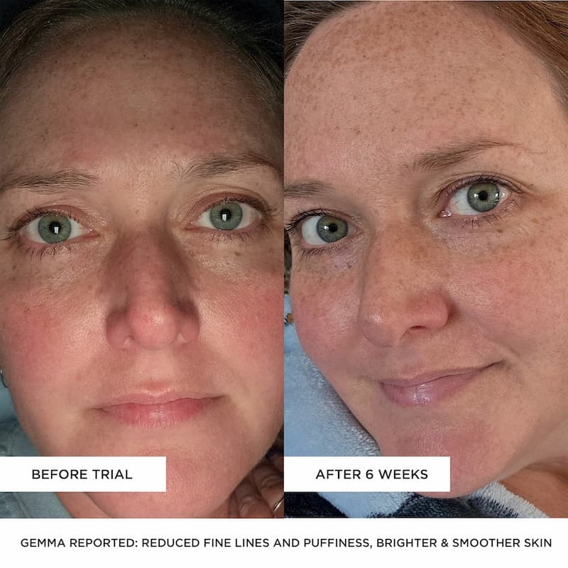 BEAUTYPRO LED mask results before and after