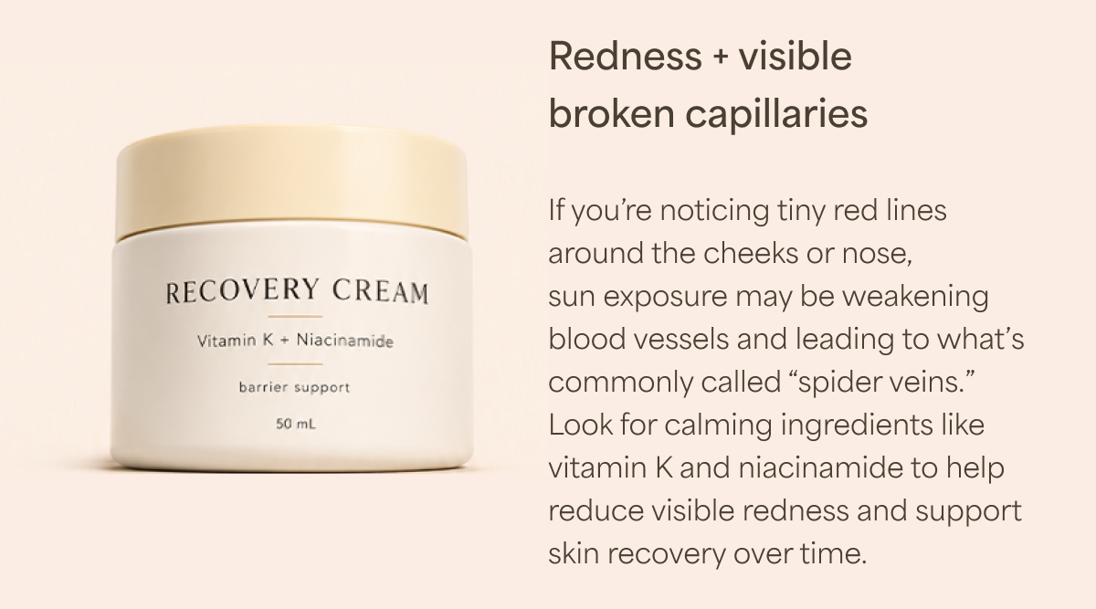 Vitamin K + Niacinamide help with redness and visible broken capillaries