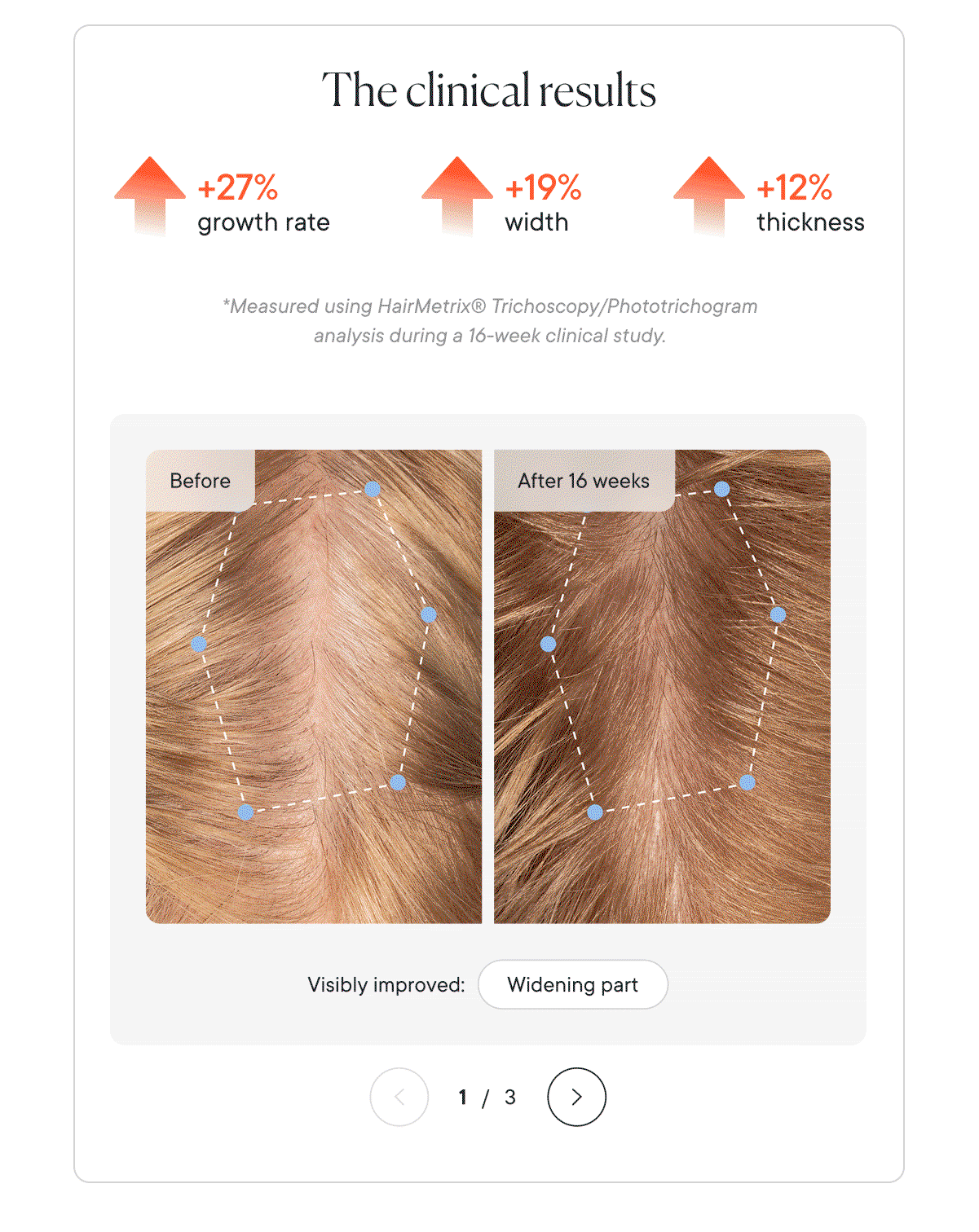 The clinical results