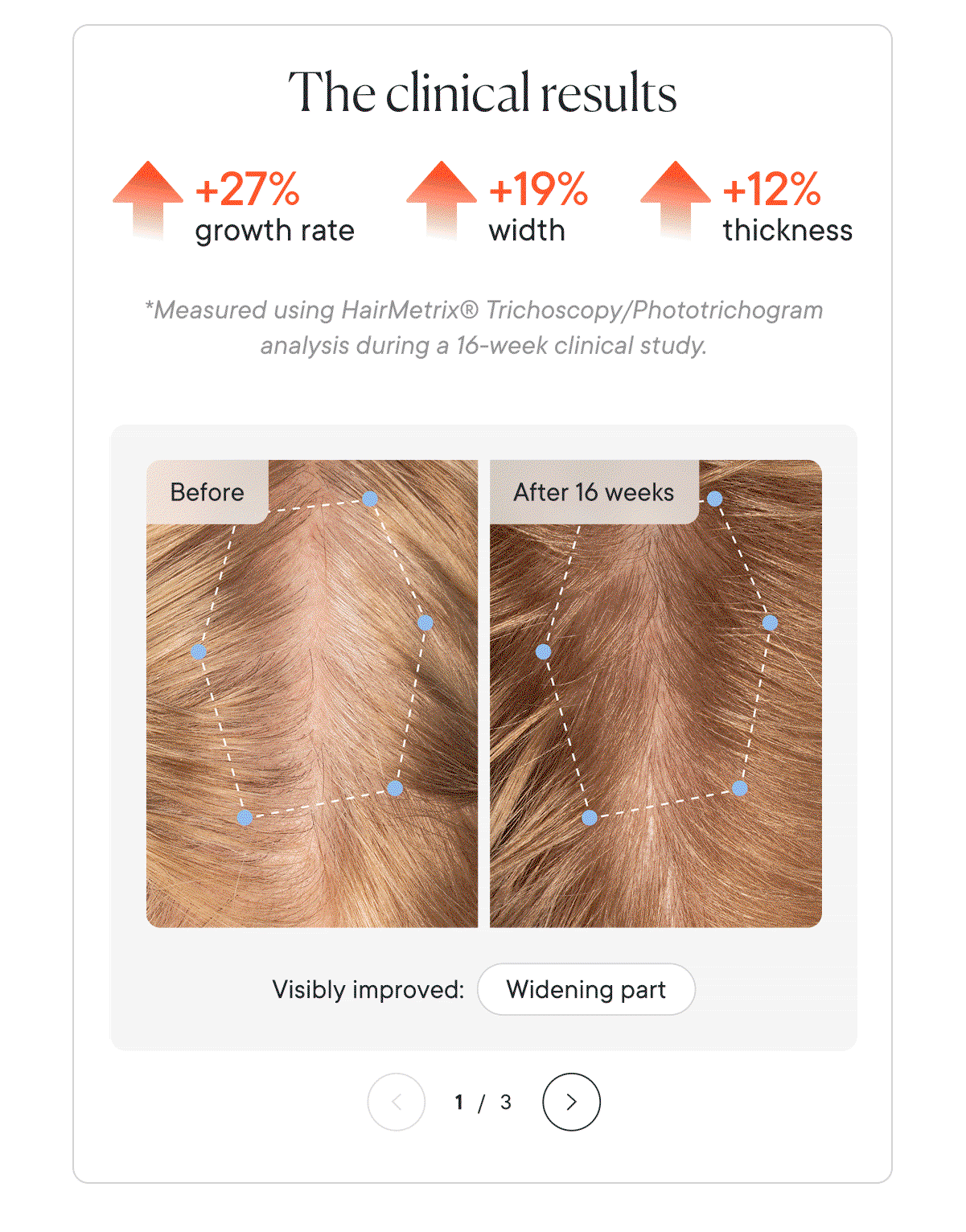 The clinical results