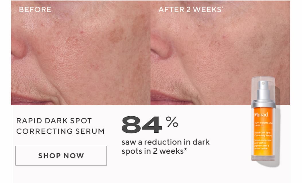 Rapid Dark Spot Correcting Serum