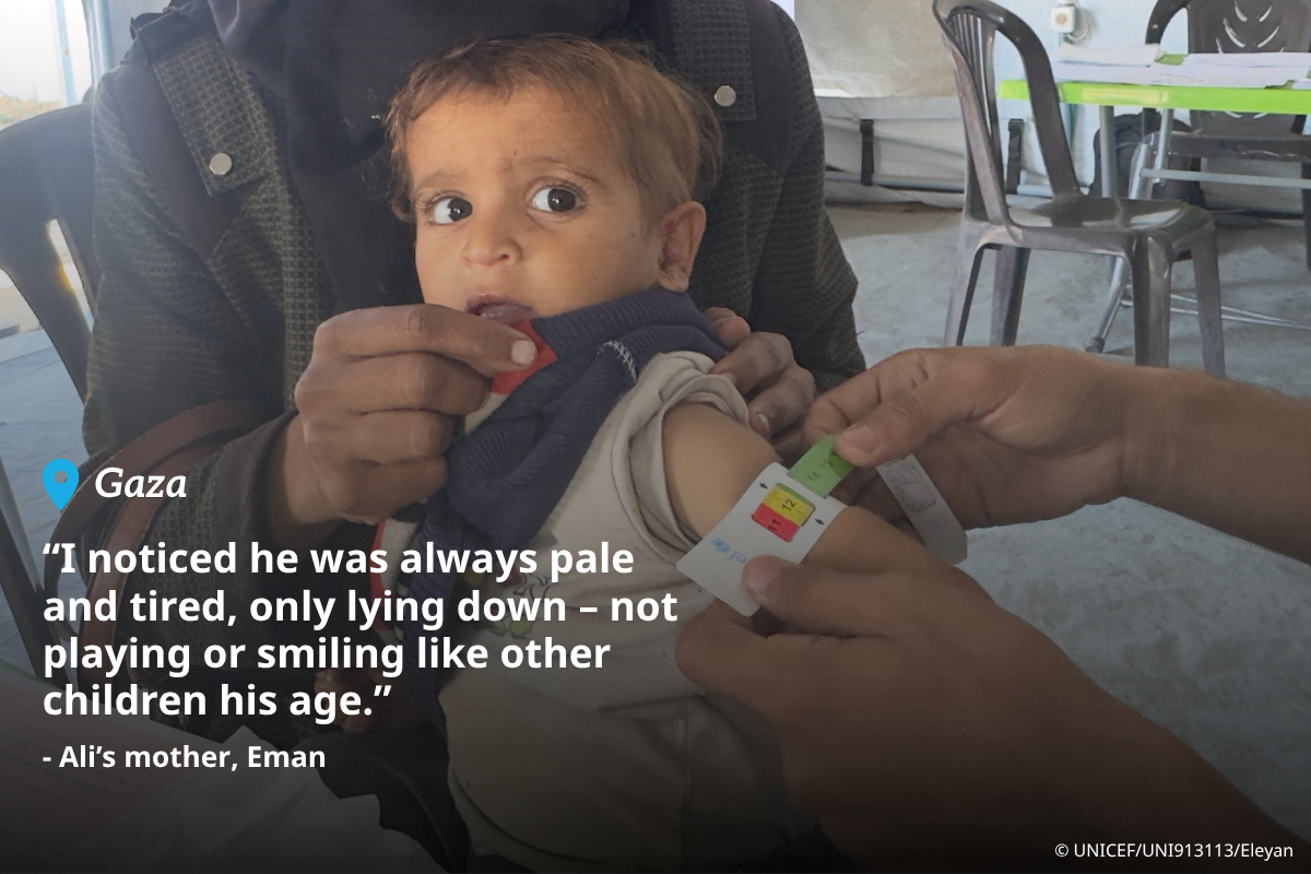 Eman holds her one-year-old son Ali as he is tested for malnutrition at a UNICEF-supported nutrition centre, where he was later diagnosed with severe acute malnutrition.