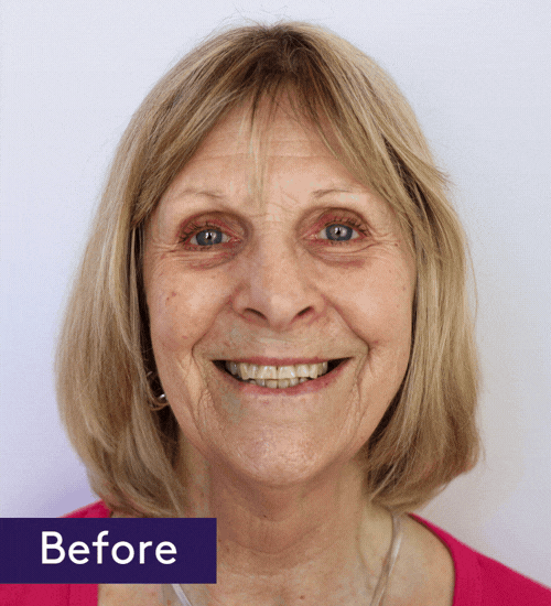 As we age, dark circles can leave our eyes looking more tired and less defined With the right techniques and products, you can easily smooth away shadows for a well-rested look