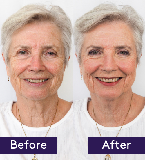 See how Brow Shape can lift and define your brows Sally shows how to transform your look by adding natural definition to your brows using Bring Back Brow Shape