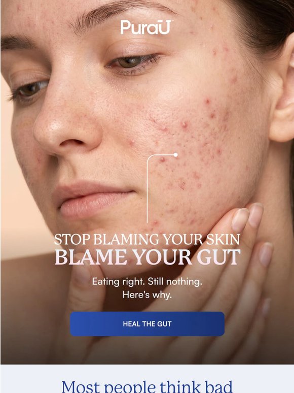 What if you've been wrong about collagen?