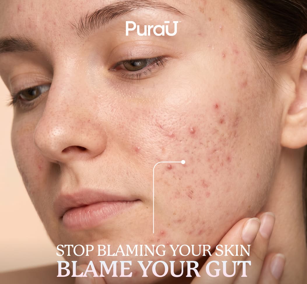 Stop Blaming Your Skin Blame Your Gut | Heal The Gut