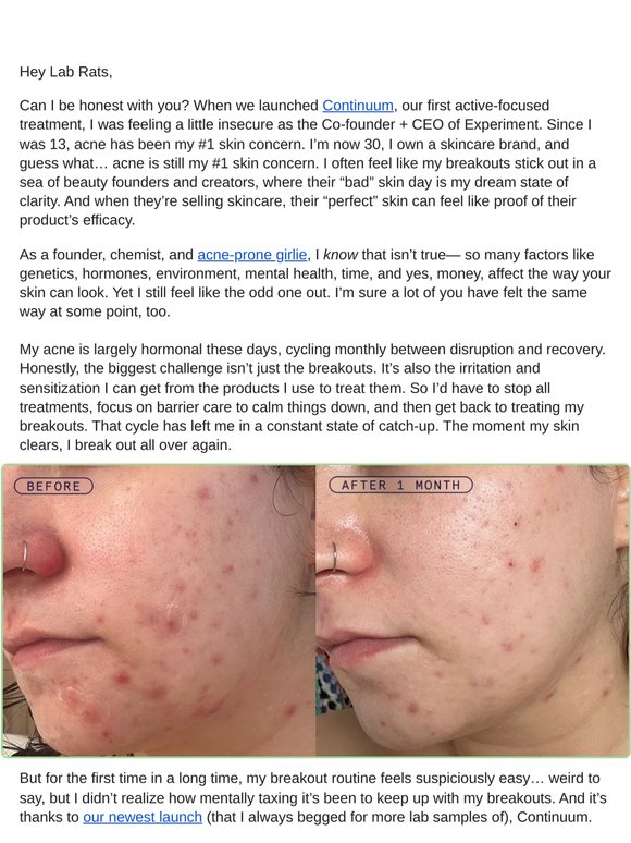 this one's for the acne-prone girlies ✨