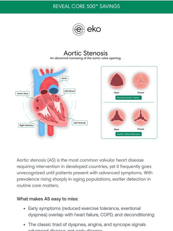 Aortic Stenosis Can Hide for Years