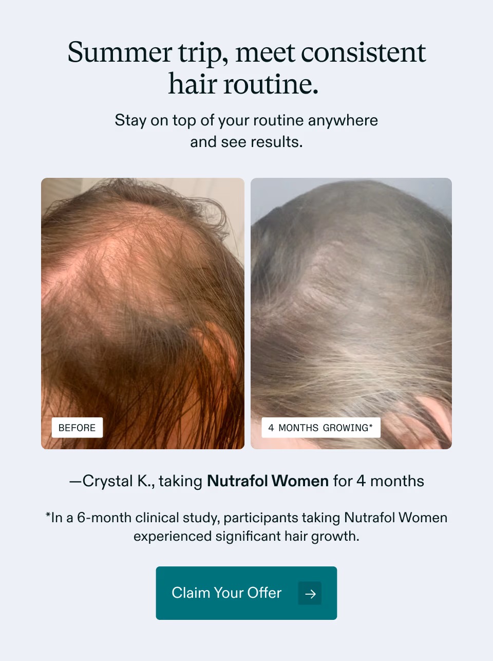 Summer trip, meet consistent hair routine. Stay on top of your routine anywhere and see results. —Crystal K., taking Nutrafol Women for 4 months *In a 6-month clinical study, participants taking Nutrafol Women experienced significant hair growth. Claim Your Offer →