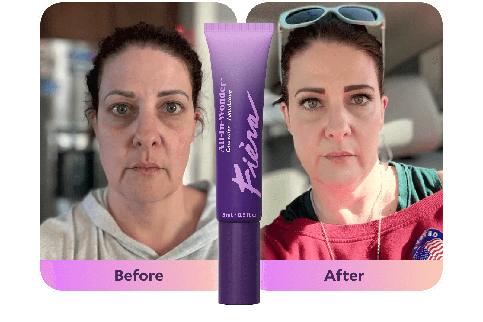 Before After
