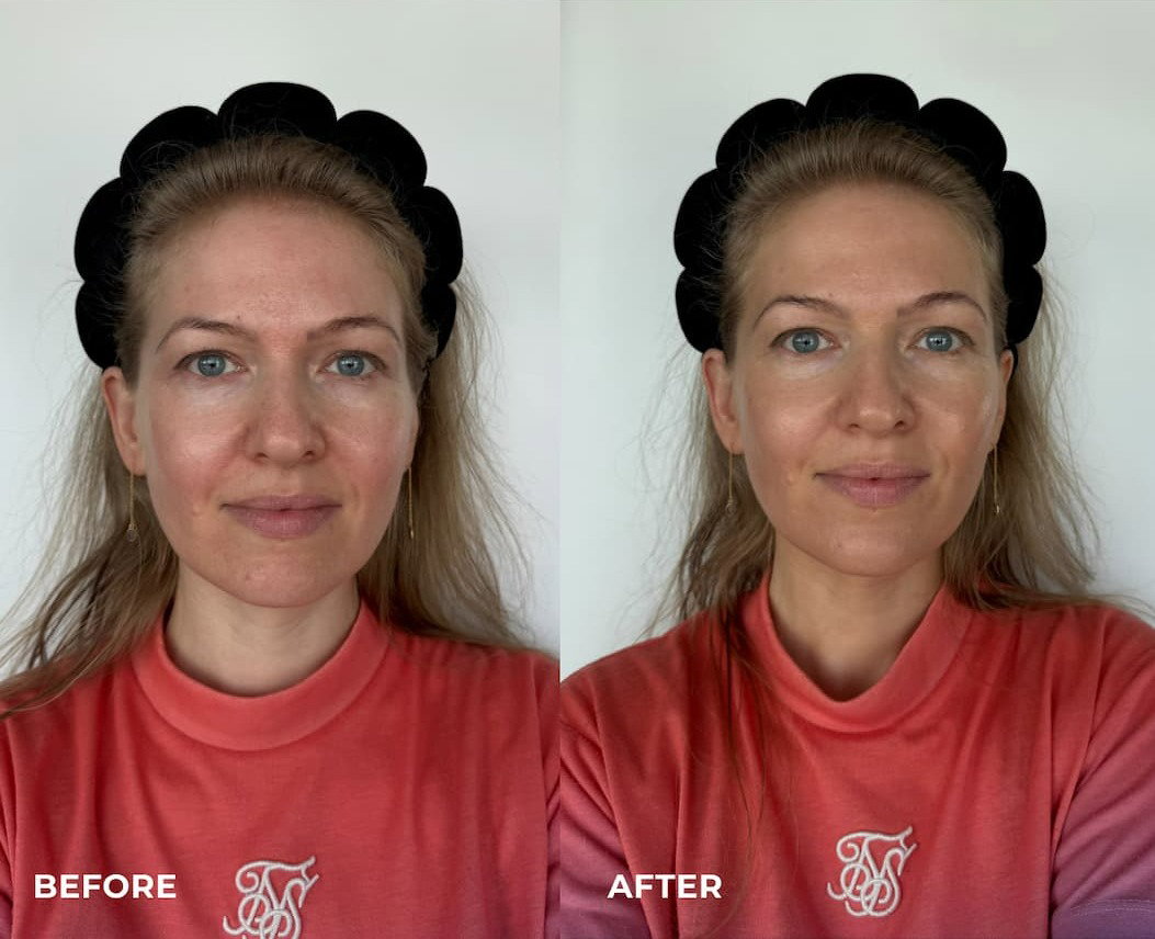 Before and After