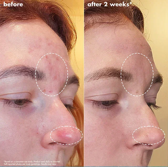 before & after
