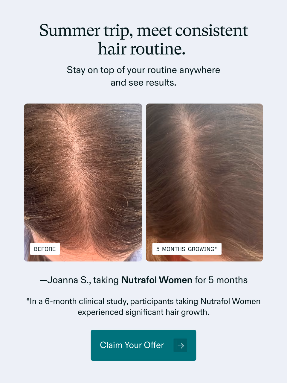 Summer trip, meet consistent hair routine. Stay on top of your routine anywhere and see results. —Joanna S., taking Nutrafol Women for 5 months *In a 6-month clinical study, participants taking Nutrafol Women experienced significant hair growth. Claim Your Offer →