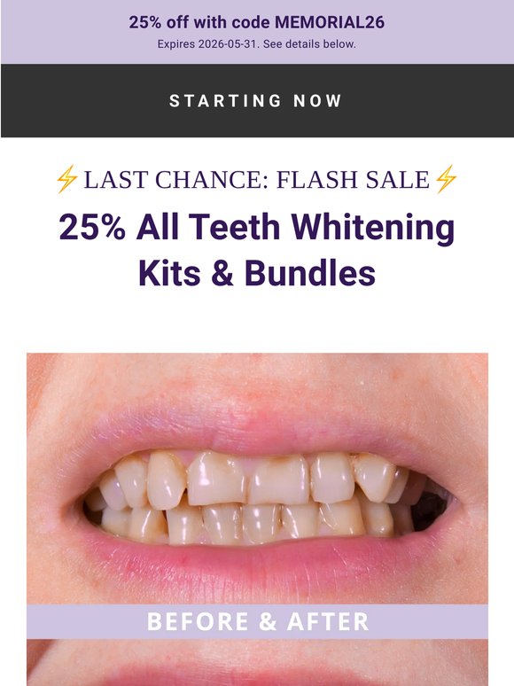 ⏰ LAST CALL: 25% Off Teeth whitening
