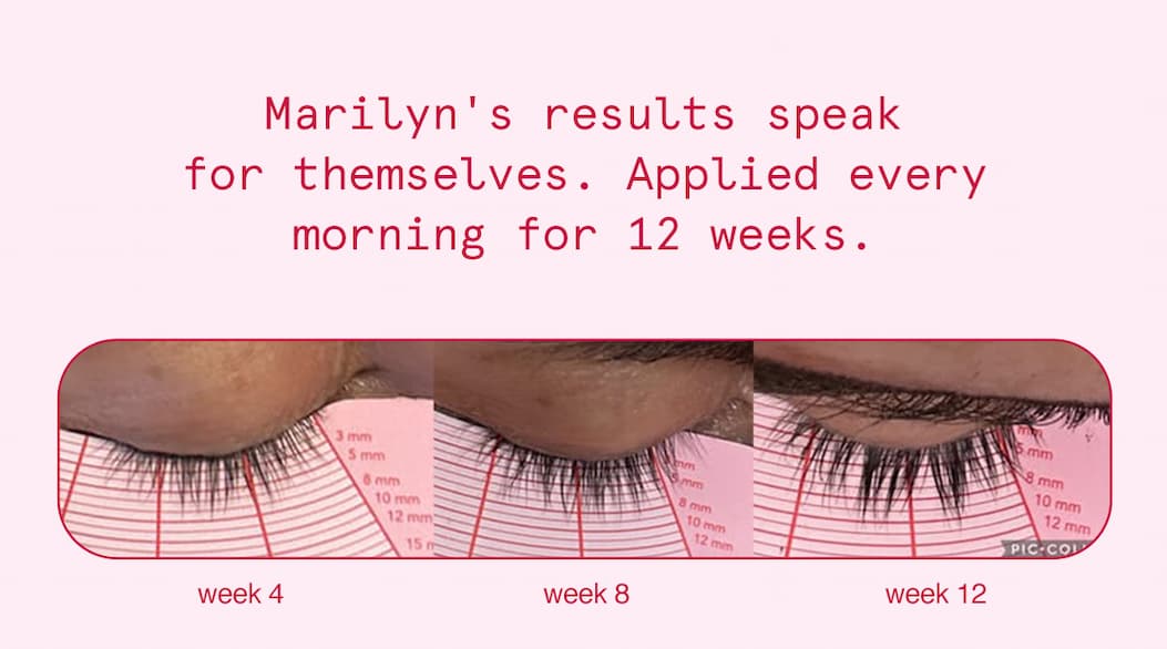 Marilyn's results speak for themselves. Applied every morning for 12 weeks.
