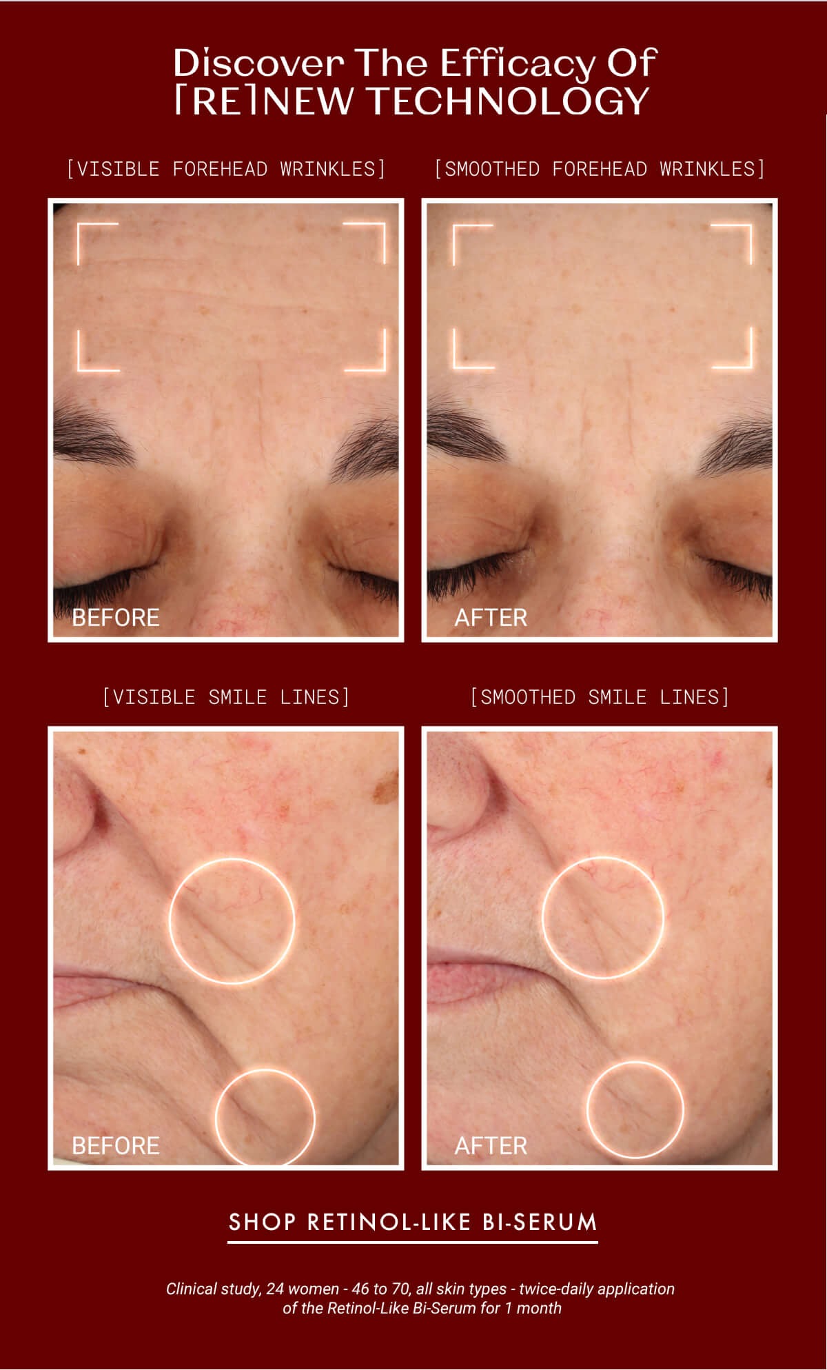 Science Meets Skin Renewal