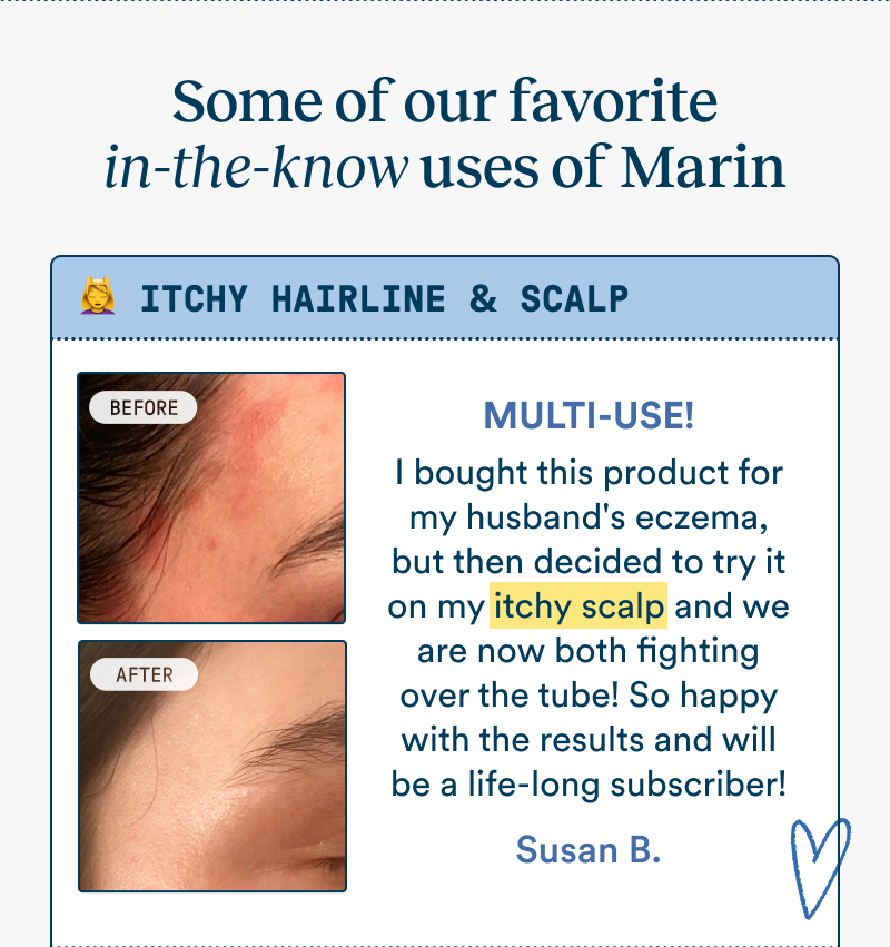 Before-and-after photos showing improvement in redness and irritation along the hairline after using Marin. Customer review shares that the product helped soothe an itchy scalp and became a household favorite.Before-and-after photos showing improvement in redness and irritation along the hairline after using Marin. Customer review shares that the product helped soothe an itchy scalp and became a household favorite.