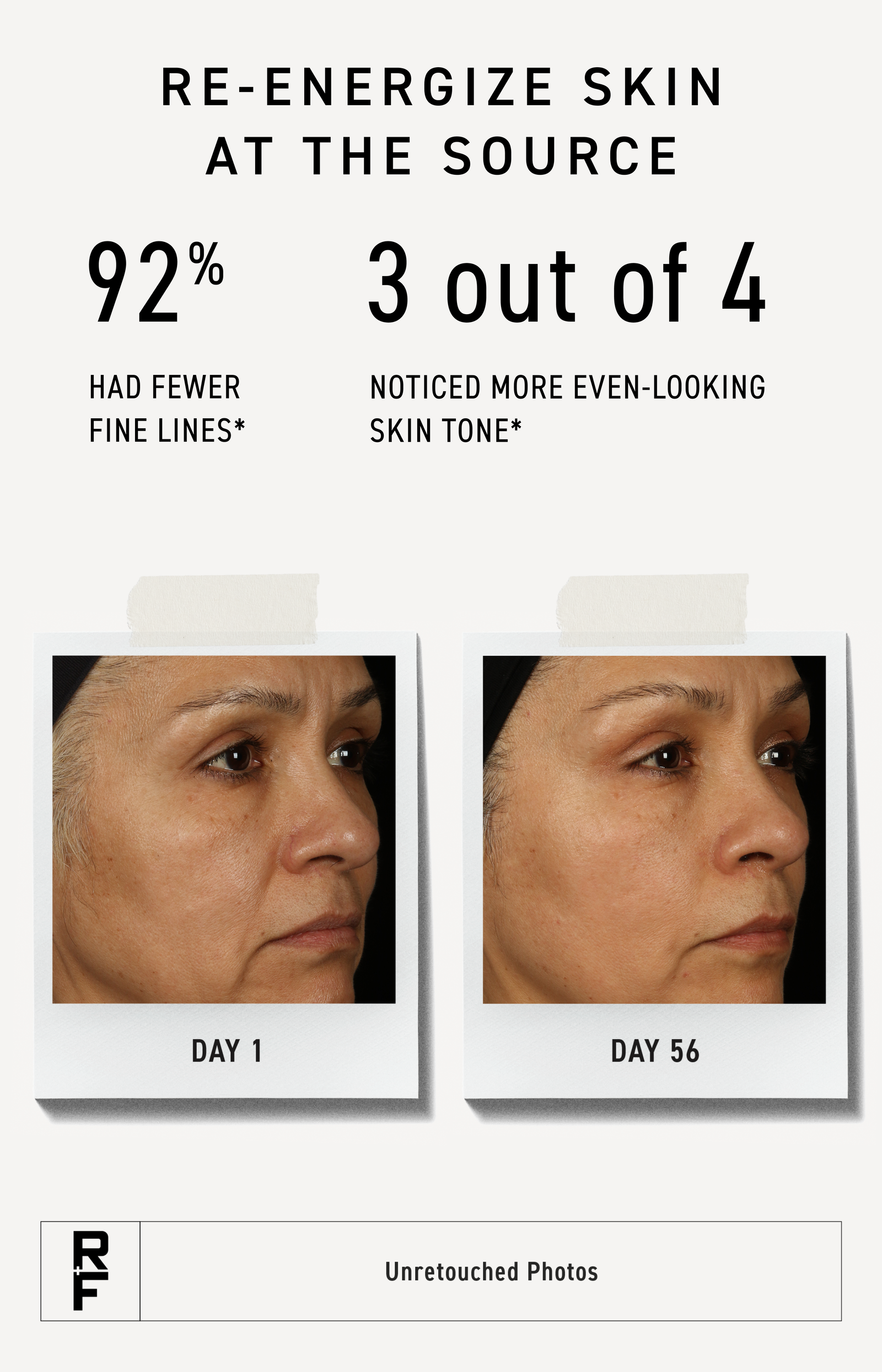 92% had fewer fine lines and 3 out of 4 women noticed more even-looking skin tone.