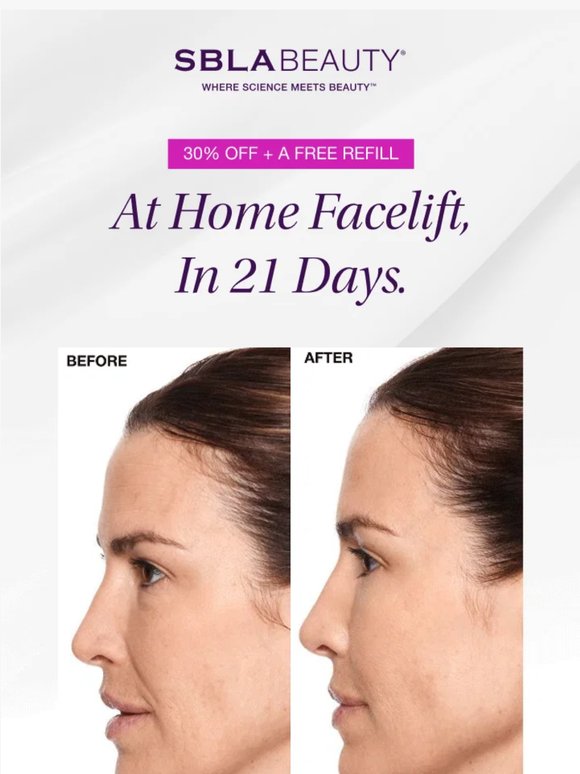 The only facelift that gets better each time you use it.