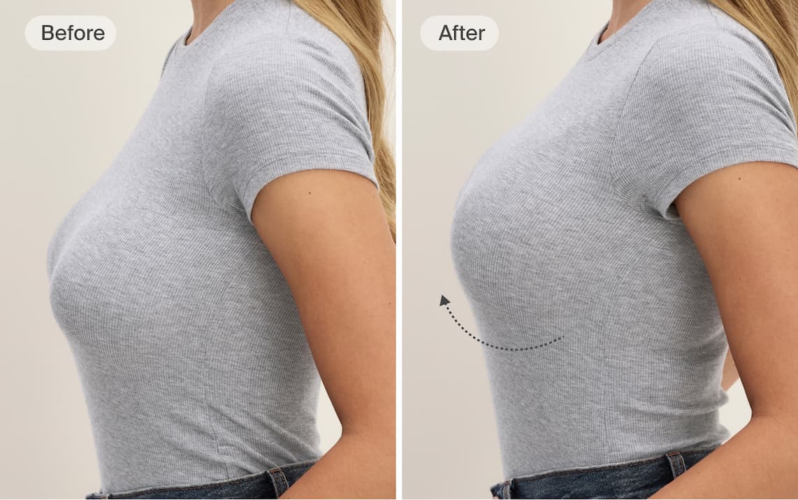 Before & After