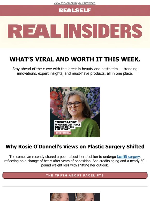 Rosie O'Donnell Reveals What Changed Her Perspective on Facelifts