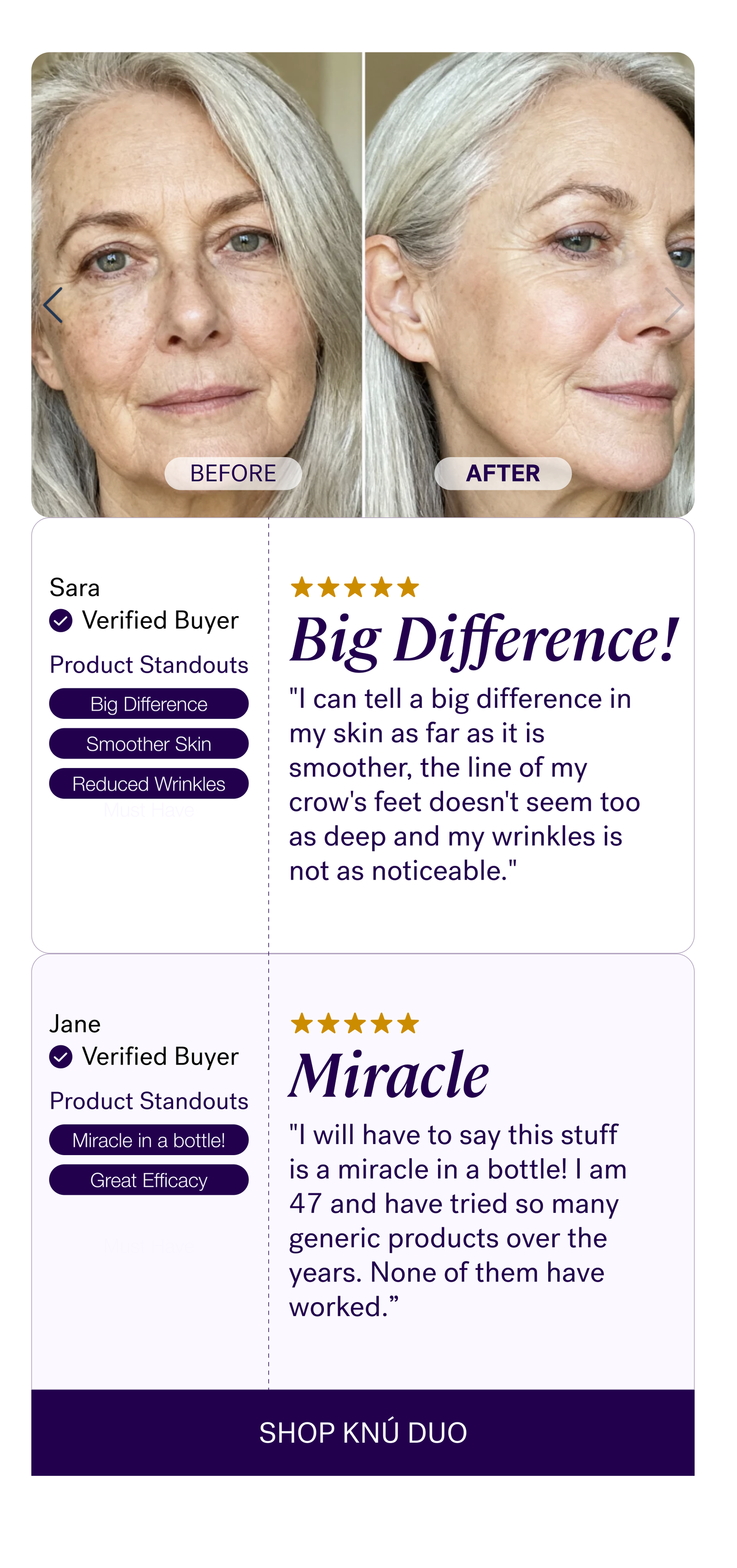 "I can tell a big difference in my skin as far as it is smoother,the line of my crow's feet doesn't seem too as deep and mywrinkles is not as noticeable." — Sara  "I will have to say this stuff is a miracle in a bottle! I am 47 and have tried so many generic products over the years. None of them have worked.”— Jane  CTA: SHOP KNÚ DUO